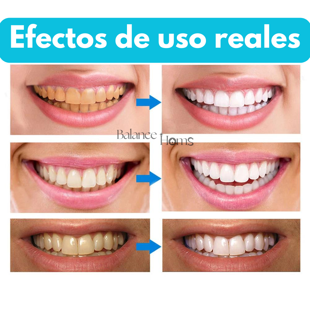 Lápiz Blanqueador Dental - Mantén tus dientes blancos y relucientes